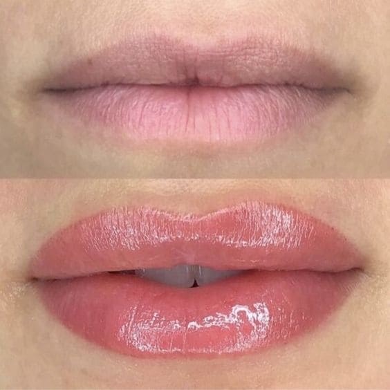 Micropigmentação labial antes e depois